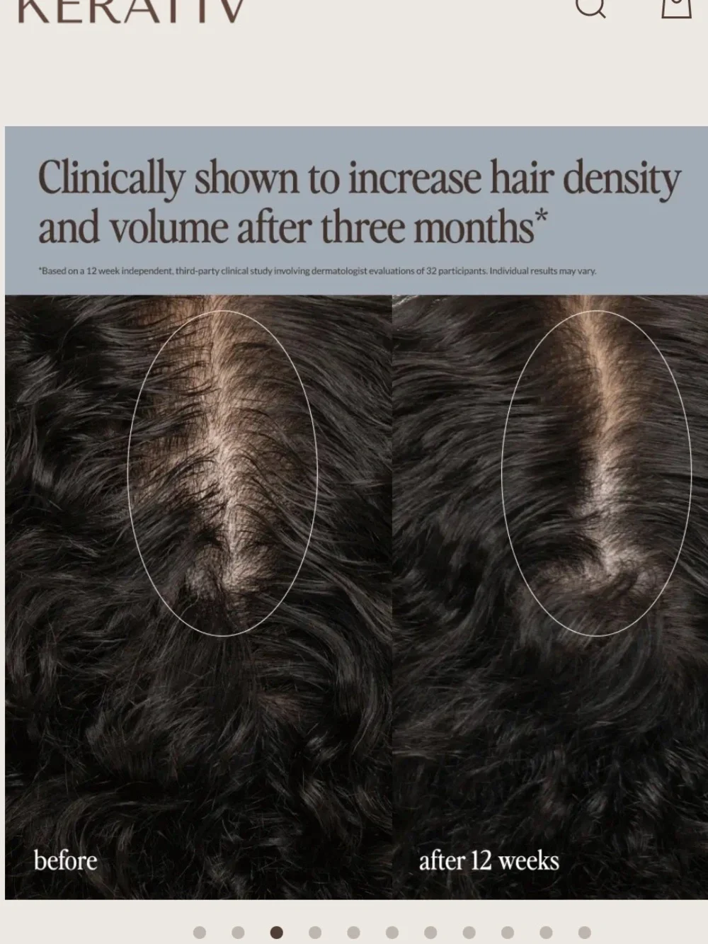 Kerativ redensify treatment